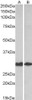 43-640 (0.3ug/ml) staining of HeLa lysate (35ug protein in RIPA buffer) . Primary incubation was 1 hour. Detected by chemiluminescence.