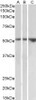 43-656 (1ug/ml) staining of Mouse Thymus lysate (35ug protein in RIPA buffer) . Primary incubation was 1 hour. Detected by chemiluminescence.