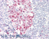 43-702 (2ug/ml) staining of Human Breast cancer lysate (35ug protein in RIPA buffer) . Primary incubation was 1 hour. Detected by chemiluminescence.