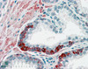 45-001 (3.8ug/ml) staining of paraffin embedded Human Prostate. Steamed antigen retrieval with citrate buffer pH 6, AP-staining.
