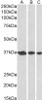 45-009 (0.3ug/ml) staining of A431 (A) , HeLa (B) and MCF7 (C) nuclear lysates (35ug protein in RIPA buffer) . Primary incubation was 1 hour. Detected by chemiluminescence.