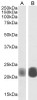 45-027 (5ug/ml) staining of paraffin embedded Human Heart. Steamed antigen retrieval with citrate buffer pH 6, AP-staining. <strong>This data is from a previous batch, not on sale.</strong>