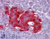 45-039 (0.1ug/ml) staining of isoform 1+ 2 Human Kidney lysate (35ug protein in RIPA buffer) . Detected by chemiluminescence.