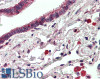 45-050 Immunofluorescence analysis of paraformaldehyde fixed MCF7 cells, permeabilized with 0.15% Triton. Primary incubation 1hr (10ug/ml) followed by Alexa Fluor 488 secondary antibody (2ug/ml) , showing plasma membrane/cytoplasmic staining. The nuclear