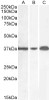 45-060 (0.01ug/ml) staining of Mouse Spleen (A) , (0.1ug/ml) Rat Brain (B) and (0.5ug/ml) Rat Spleen (C) (35ug protein in RIPA buffer) . Detected by chemiluminescence.