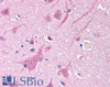 45-069 (0.1ug/ml) staining of Human Brain lysate (35ug protein in RIPA buffer) . Primary incubation was 1 hour. Detected by chemiluminescence.