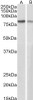 45-076 (0.3ug/ml) staining of A431 (A) and NIH3T3 (B) cell lysates (35ug protein in RIPA buffer) . Primary incubation was 1 hour. Detected by chemiluminescence.