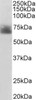 45-079 staining (0.3ug/ml) of Human Spleen lysate (RIPA buffer, 35ug total protein per lane) . Detected by chemiluminescence.