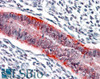 45-090 (0.03ug/ml) staining of Human Breast lysate (35ug protein in RIPA buffer) . Primary incubation was 1 hour. Detected by chemiluminescence.