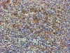 45-095 (4ug/ml) staining of paraffin embedded Human Tonsil. Steamed antigen retrieval with Tris/EDTA buffer pH 9, HRP-staining. These results could not been obtained after antigen retireval at pH6 with this batch of antibody.