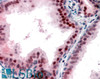 45-800 (0.1ug/ml) staining of Human Prostate lysate (35ug protein in RIPA buffer) . Primary incubation was 1 hour. Detected by chemiluminescence.