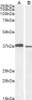 45-106 staining (1ug/ml) of A549 (A) and PD19 (B) cell lysate (RIPA buffer, 30ug total protein per lane) . Detected by chemiluminescence.