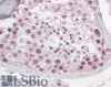 45-109 (3.8ug/ml) staining of paraffin embedded Human Testis. Steamed antigen retrieval with citrate buffer pH 6, AP-staining.