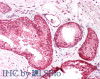 45-110 (5ug/ml) staining of paraffin embedded Human Colon. Steamed antigen retrieval with citrate buffer pH 6, AP-staining.