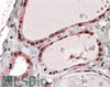 45-120 (2ug/ml) staining of Human Thymus (A) and Human Lymph node (B) lysates (35ug protein in RIPA buffer) . Primary incubation was 1 hour. Detected by chemiluminescence.