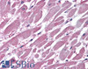 45-120 (3.75ug/ml) staining of paraffin embedded Human Thyroid Gland. Steamed antigen retrieval with citrate buffer pH 6, AP-staining. <strong>This data is from a previous batch, not on sale.</strong>