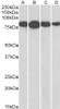 45-137 (0.03ug/ml) staining of Human Tonsil lysate (35ug protein in RIPA buffer) . Detected by chemiluminescence.