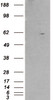 HEK293 overexpressing RXRB and probed with 45-140 (mock transfection in first lane) .
