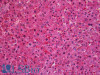 45-141 (3.75ug/ml) staining of paraffin embedded Human Liver. Steamed antigen retrieval with citrate buffer pH 6, AP-staining. <strong>This data is from a previous batch, not on sale.</strong>