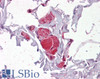 45-168 (2.5ug/ml) staining of paraffin embedded Human Colon. Steamed antigen retrieval with citrate buffer pH 6, AP-staining.