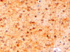 45-220 (0.5ug/ml) staining of Human Frontal Cortex lysate (35ug protein in RIPA buffer) . Detected by chemiluminescence.