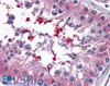 HEK293 overexpressing human ABCD1 and probed with 45-182 at 1ug/ml (mock transfection in first lane) .