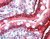 45-189 (1.5ug/ml) as the reporter antibody.