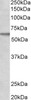 45-200 (2ug/ml) staining of MCF7 lysate (35ug protein in RIPA buffer) . Primary incubation was 1 hour. Detected by chemiluminescence.