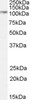 HEK293 overexpressing ARA9 and probed with 45-223 (mock transfection in first lane) .