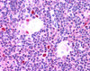 45-226 staining (0.05ug/ml) of HEK293 cell lysates. Untransfected (Lane 3) and transfected with Human AIRE (lane 4) . Data kindly provided by Prof. Pärt Peterson, University of Tartu, Estonia.