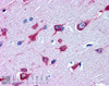 45-244 (3.8ug/ml) staining of paraffin embedded Human Cortex. Steamed antigen retrieval with citrate buffer pH 6, AP-staining.