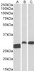 45-272 (0.1ug/ml) staining of Human Tonsil (A) and Rat (B) and Pig (C) Spleen lysate (35ug protein in RIPA buffer) . Primary incubation was 1 hour. Detected by chemiluminescence.