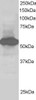 45-321 staining (1ug/ml) of Human Kidney lysate (RIPA buffer, 30ug total protein per lane) . Primary incubated for 1 hour. Detected by chemiluminescence.