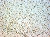 45-355 (0.1ug/ml) staining of Rat Brain lysate (35ug protein in RIPA buffer) . Detected by chemiluminescence.