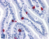 45-366 (1ug/ml) staining of Human Lung lysate (35ug protein in RIPA buffer) . Primary incubation was 1 hour. Detected by chemiluminescence.