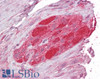 45-398 (2.5ug/ml) staining of paraffin embedded Human Small Intestine. Steamed antigen retrieval with citrate buffer pH 6, AP-staining. <strong>This data is from a previous batch, not on sale.</strong>