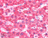 45-408 (5ug/ml) staining of paraffin embedded Human Liver. Steamed antigen retrieval with citrate buffer pH 6, AP-staining. <strong>This data is from a previous batch, not on sale.</strong>