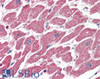 45-426 (4ug/ml) staining of paraffin embedded Human Kidney. Steamed antigen retrieval with citrate buffer pH 6, AP-staining.<strong>This data is from a previous batch, not on sale.</strong>