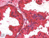 45-428 (2.5ug/ml) staining of paraffin embedded Human Prostate. Steamed antigen retrieval with citrate buffer pH 6, AP-staining.