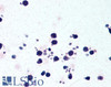 45-435 (5ug/ml) staining of paraffin embedded Human Peripheral Blood Leukocytes. Steamed antigen retrieval with citrate buffer pH 6, AP-staining. <strong>This data is from a previous batch, not on sale.</strong>