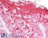 45-450 (2.5ug/ml) staining of paraffin embedded Human Tonsil. Steamed antigen retrieval with citrate buffer pH 6, AP-staining. This data was obtained using a previous batch.