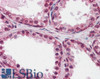 45-625 (0.3ug/ml) staining of Human Brain (Cerebellum) lysate (35ug protein in RIPA buffer) . Detected by chemiluminescence.