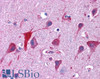 45-455 (3.75ug/ml) staining of paraffin embedded Human Spleen. Steamed antigen retrieval with citrate buffer pH 6, AP-staining.
