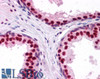 45-470 (2.5ug/ml) staining of paraffin embedded Human Prostate. Steamed antigen retrieval with citrate buffer pH 6, AP-staining. <strong>This data is from a previous batch, not on sale.</strong>