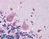 45-480 (3.75ug/ml) staining of paraffin embedded Human Cortex. Steamed antigen retrieval with citrate buffer pH 6, AP-staining.