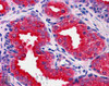 45-503 (3.8ug/ml) staining of paraffin embedded Human Prostate. Steamed antigen retrieval with citrate buffer pH 6, AP-staining. <strong>This data is from a previous batch, not on sale.</strong>