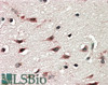 45-511 staining (0.1ug/ml) of COS1 cell lysates: untransfected (left lane) and transfected with full length recombinant Human DYX1C1 (right lane) . Data kindly provided by Wang and LoTurco, University of Connecticut, USA.