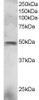 45-527 staining (3ug/ml) of NCI-H460 lysate (RIPA buffer, 30ug total protein per lane) . Primary incubated for 1 hour. Detected by western blot using chemiluminescence.
