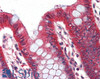45-127 (5ug/ml) staining of paraffin embedded Human Thyroid. Steamed antigen retrieval with citrate buffer pH 6, AP-staining.