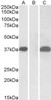 45-549 (10ug/ml) staining of paraffin embedded Human Prostate. Steamed antigen retrieval with citrate buffer pH 6, AP-staining. <strong>This data is from a previous batch, not on sale.</strong>